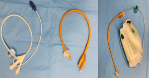 Indwelling Foley Catheter vs Supra-pubic Catheter: Differences, Benefits, and Patient Care Tips for long-term use foley2 (2)
