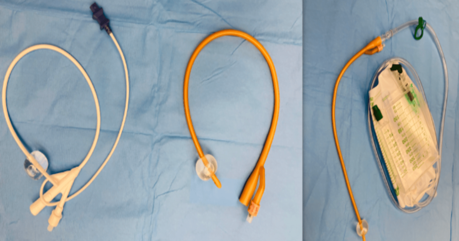 Indwelling Foley catheter vs Supra-pubic catheter